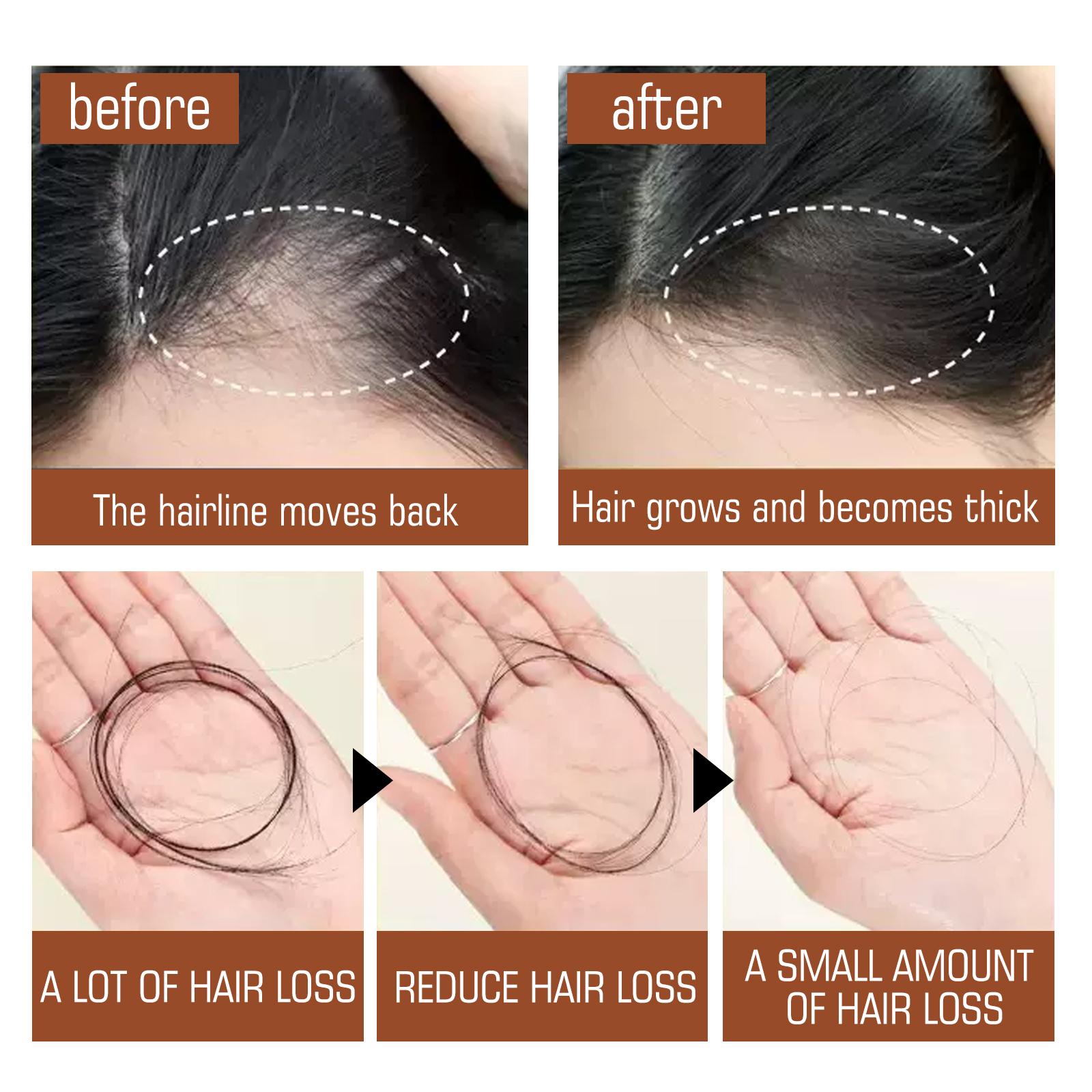 Honduras Batana Oil – Hair Nutrition & Silky Smooth Hair