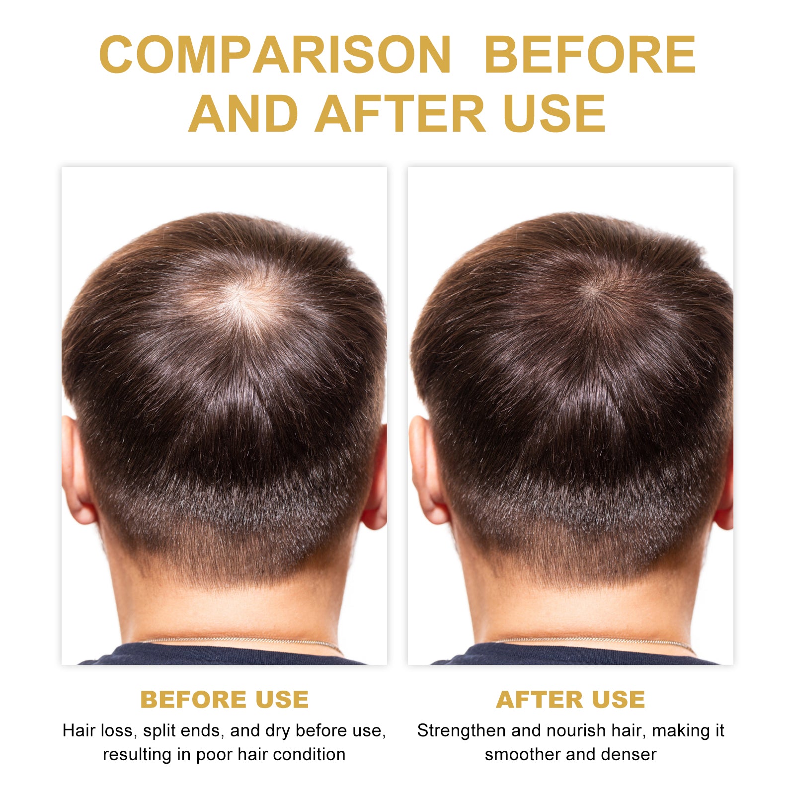 Rosemary Hair Oil – Scalp Care, Repair & Volumizing