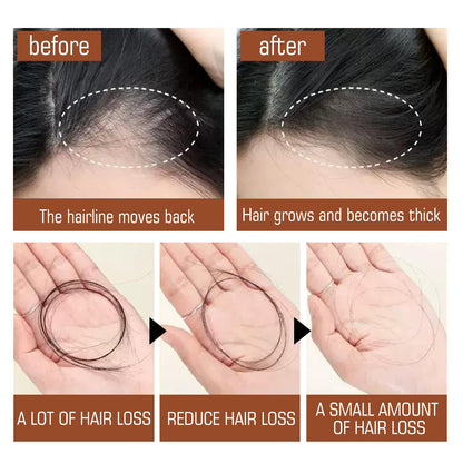 Honduras Batana Oil – Hair Nutrition &amp; Silky Smooth Hair