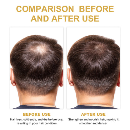Rosemary Hair Oil – Scalp Care, Repair &amp; Volumizing